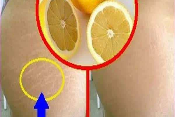 Voici Comment Utiliser La Vaseline & Le Citron Pour Enlever Les Rides & Les  Taches Brunes De La…